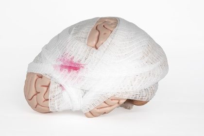 TBI May Reactivate Herpes Virus Leading to Neurodegeneration