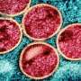 China reports 5 cases of new mpox strain