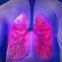 Expanded research on COPD and metabolic syndrome would advance patient-centered care, expert argues