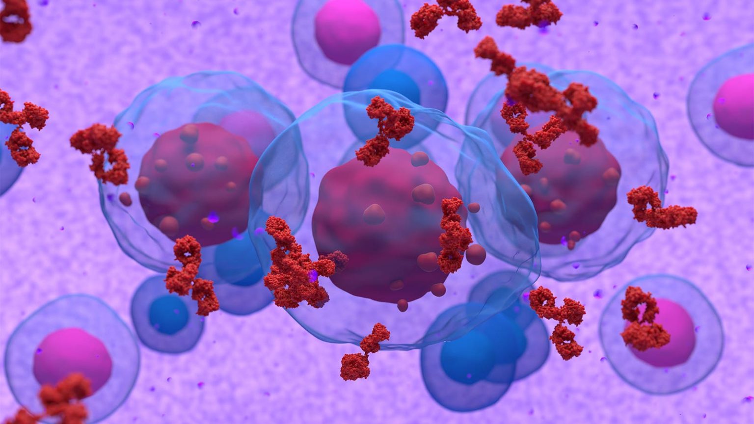High Response Rate in Heavily Treated Multiple Myeloma With Novel Drug Combination