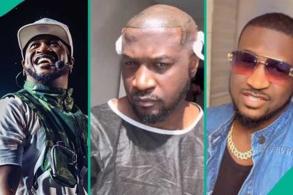 Video: See how Peter Psquare looked after his hair surgery