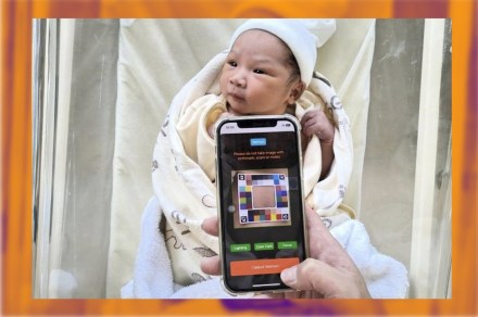 This AI app lets parents look for signs of infant jaundice at home