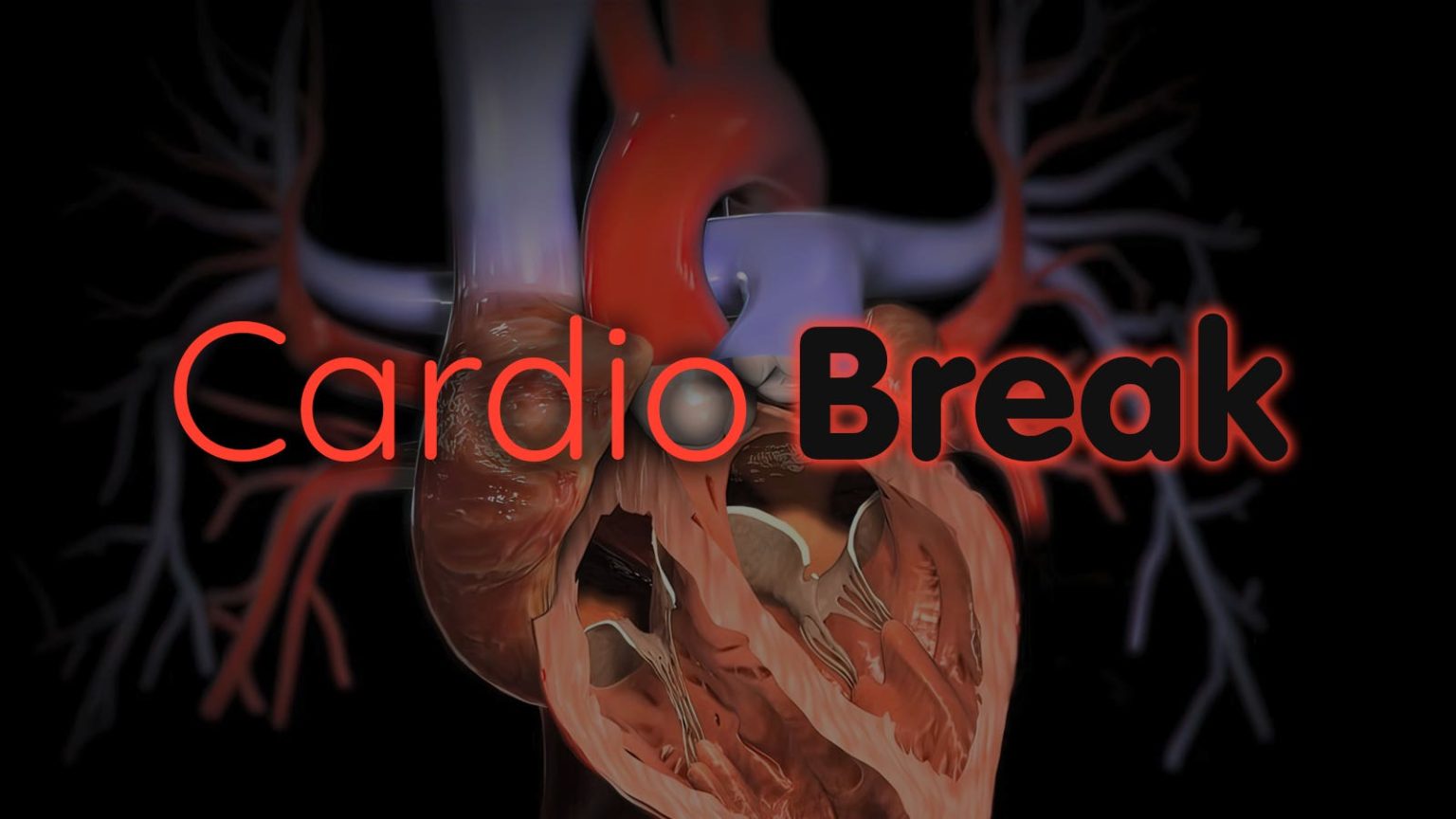 CVD Toll From Sugary Drinks; Migraine Tx and Heart Risk; Baby Heart Xenotransplant?