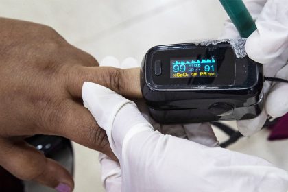 FDA Unveils Draft Guidance to Improve Pulse Oximeter Accuracy Across Skin Tones