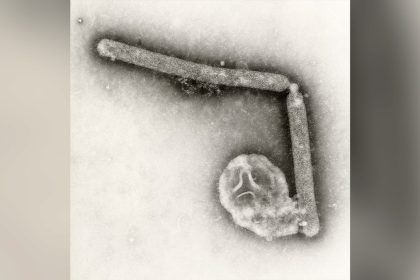 Louisiana reports first bird flu-related human death in US