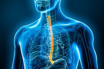 Private Equity Hospitals Have Worse Esophagectomy Outcomes