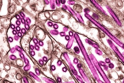 Canadian Teen Recovers From Severe H5N1 Bird Flu Infection