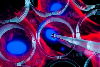 Stem Cell Transplant Effective for Children With Arthritis