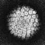 Speculum exams unnecessary for HPV screening: Research finds self-sampling just as effective