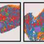 Landmark atlas reveals how aging breast tissue shapes breast cancer risk