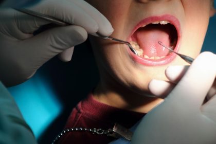 How the tiny microbes in your mouth could be putting your health at risk