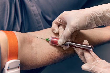 Blood Test for Early Pancreatic Cancer Shows Promise
