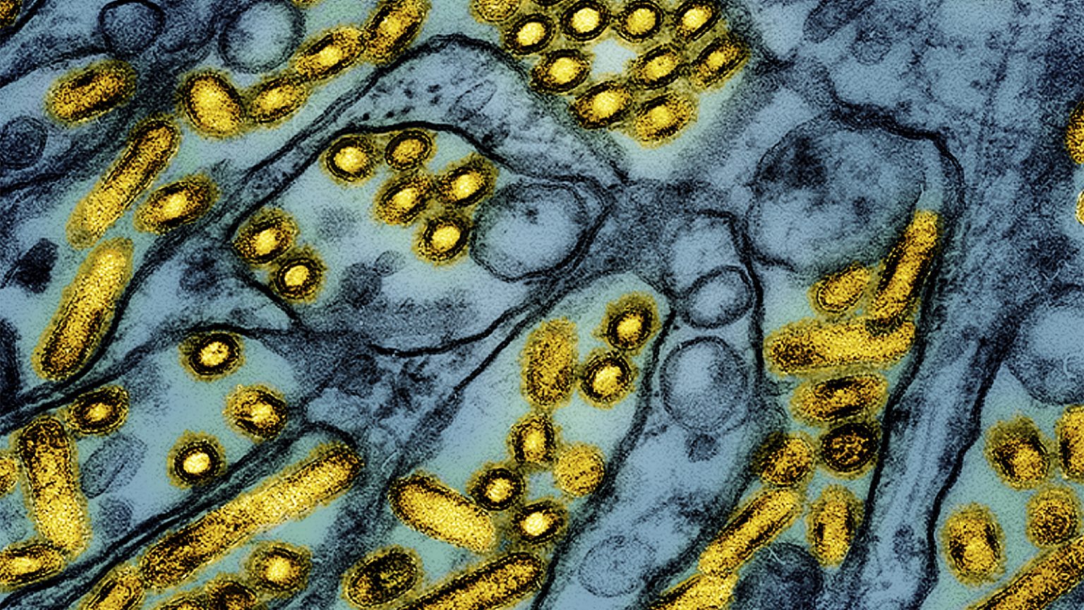 New Bird Flu Strain Detected in a Nevada Dairy Worker, CDC Says