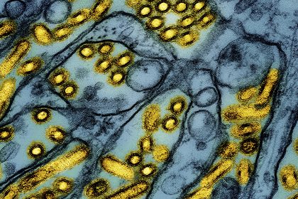 New Bird Flu Strain Detected in a Nevada Dairy Worker, CDC Says