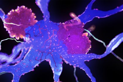 Blood Test Detects  Alzheimer’s Pathology in Other Clinical Syndromes