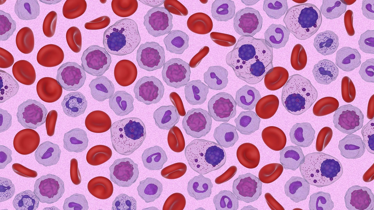 Anti-CD38-Based Quadruplet Improves Outcomes in Transplant-Ineligible Myeloma