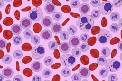 Anti-CD38-Based Quadruplet Improves Outcomes in Transplant-Ineligible Myeloma