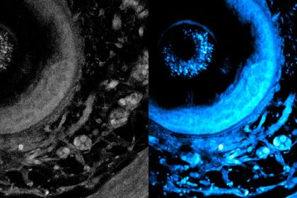 Laser imaging peers deeper into living tissue