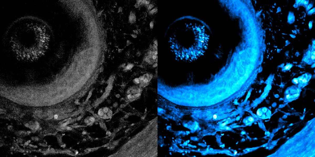 Laser imaging peers deeper into living tissue