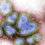 UK govt bans ‘bird gatherings’ as avian flu outbreak worsens