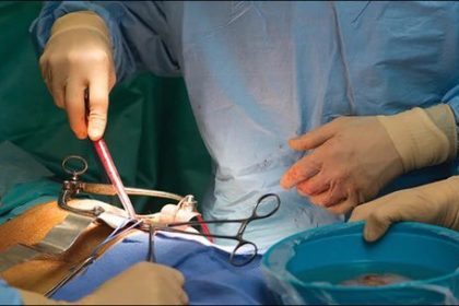 FG introduces new standards to regulate organ and tissue transplantation in Nigeria  