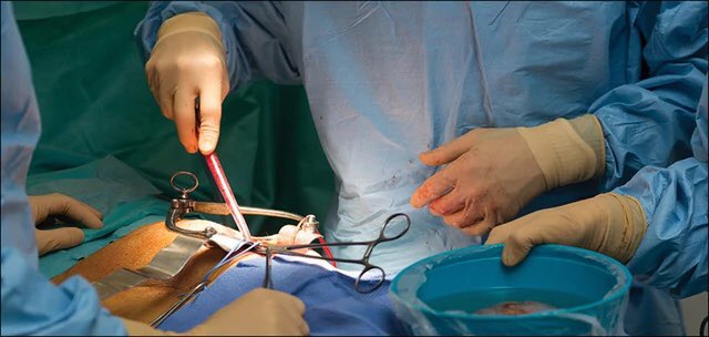 FG introduces new standards to regulate organ and tissue transplantation in Nigeria  