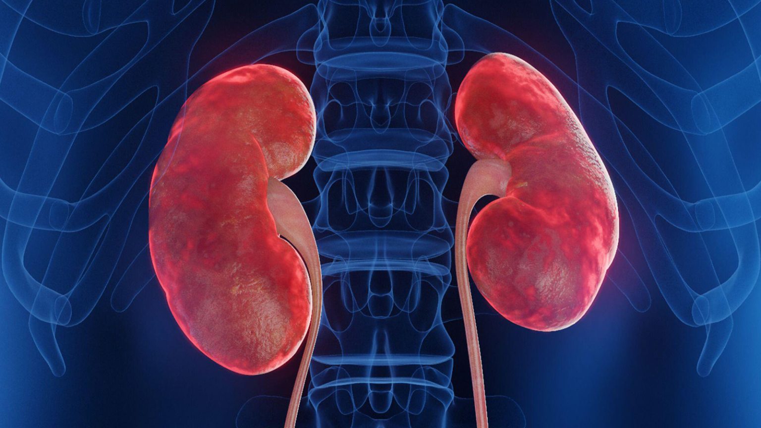 Obinutuzumab for Lupus Nephritis Boosts Complete Remissions