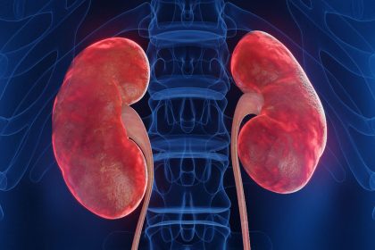 Obinutuzumab for Lupus Nephritis Boosts Complete Remissions