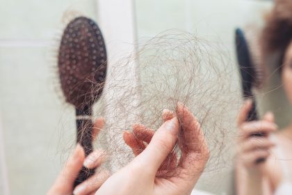 Hair Loss: Another Wegovy Side Effect?