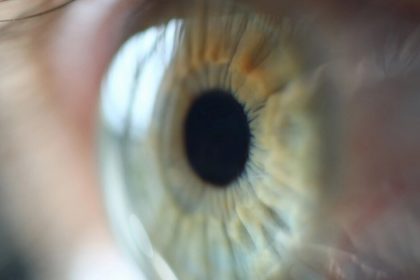 Stem cell therapy trial reverses “irreversible” damage to cornea
