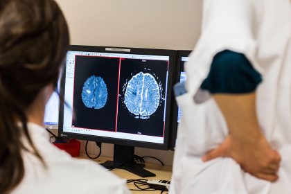 SGLT1/2 Inhibitor Cut Stroke, Heart Attack Risk in Diabetic Kidney Disease
