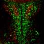 Study reveals opsin 3’s role in mouse appetite control