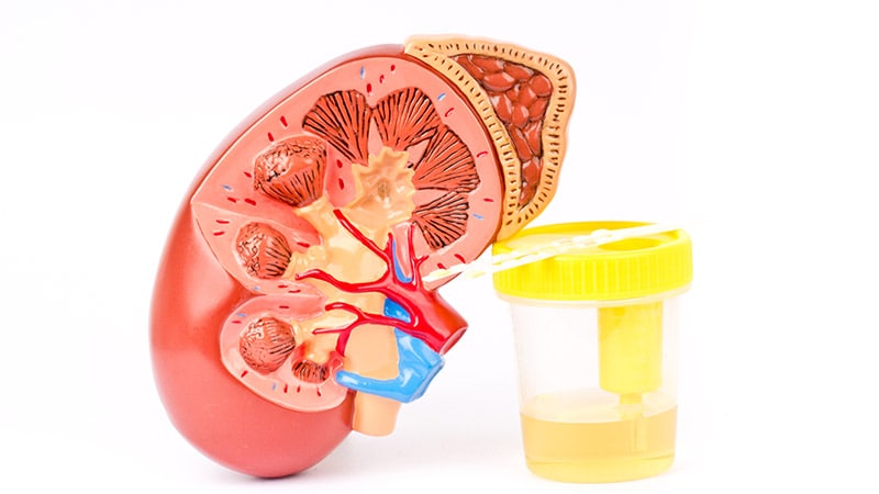 Urine Test Strips Show Promise for Kidney Disease Screening