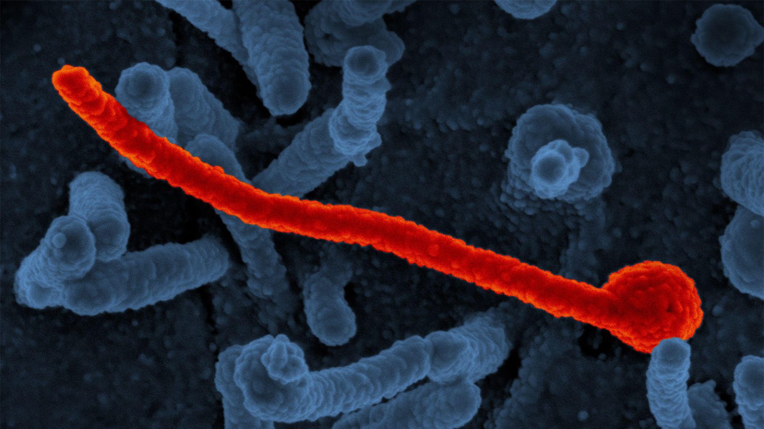 Ebola Virus Strikes Again