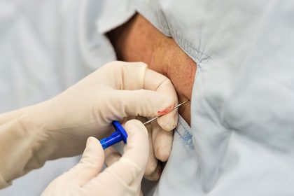 Steroid Injections for Back Pain: A Costly Shot in the Dark?
