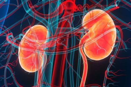 Obinutuzumab a Success in Phase 3 Trial for Lupus Nephritis