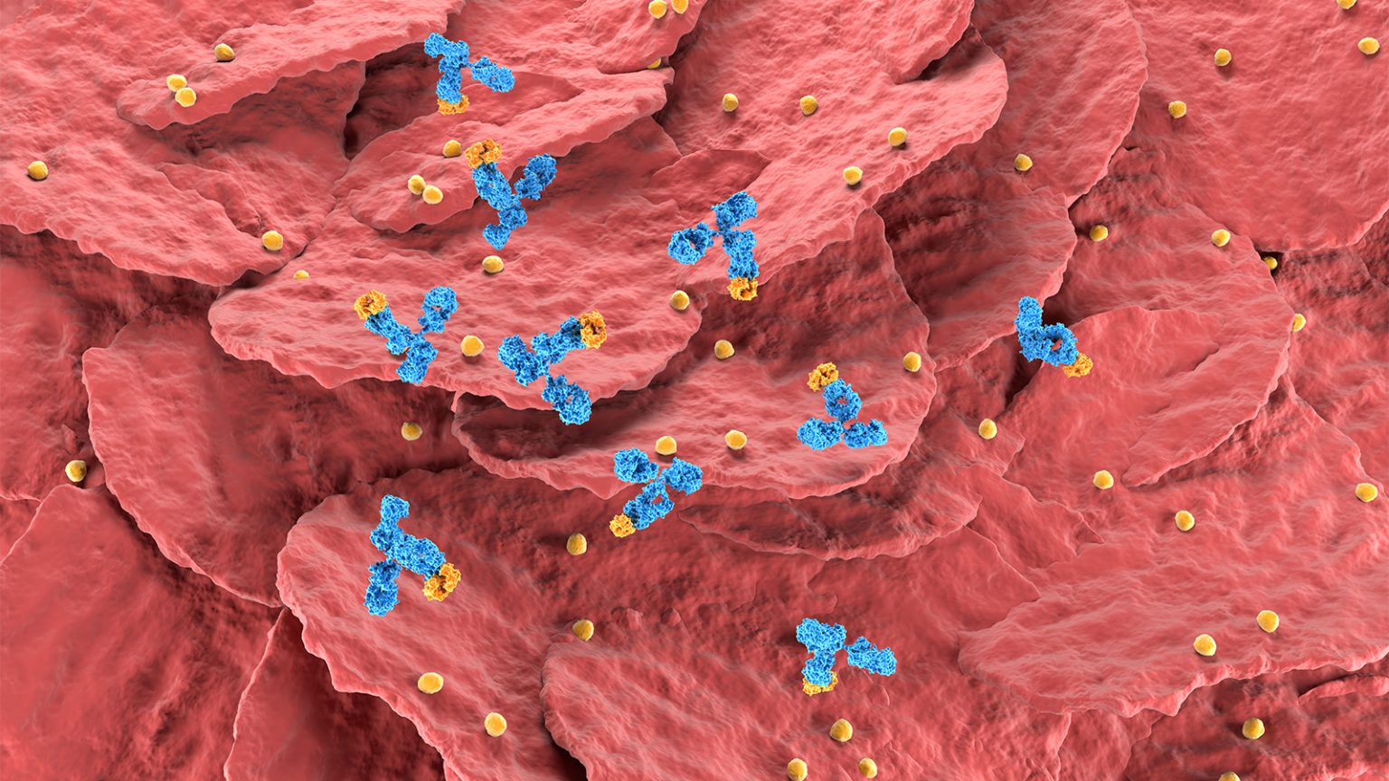 Newer Biologics Tied to Fewer Infections for Older Patients With Psoriatic Disease