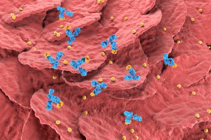 Newer Biologics Tied to Fewer Infections for Older Patients With Psoriatic Disease