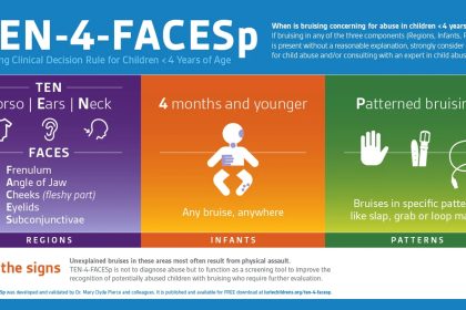 Screening Tool Identified Abuse Risk in Kids With Just One Bruise
