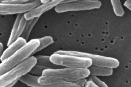U.S. Tuberculosis Cases Rose to Their Highest Levels in More Than a Dozen Years