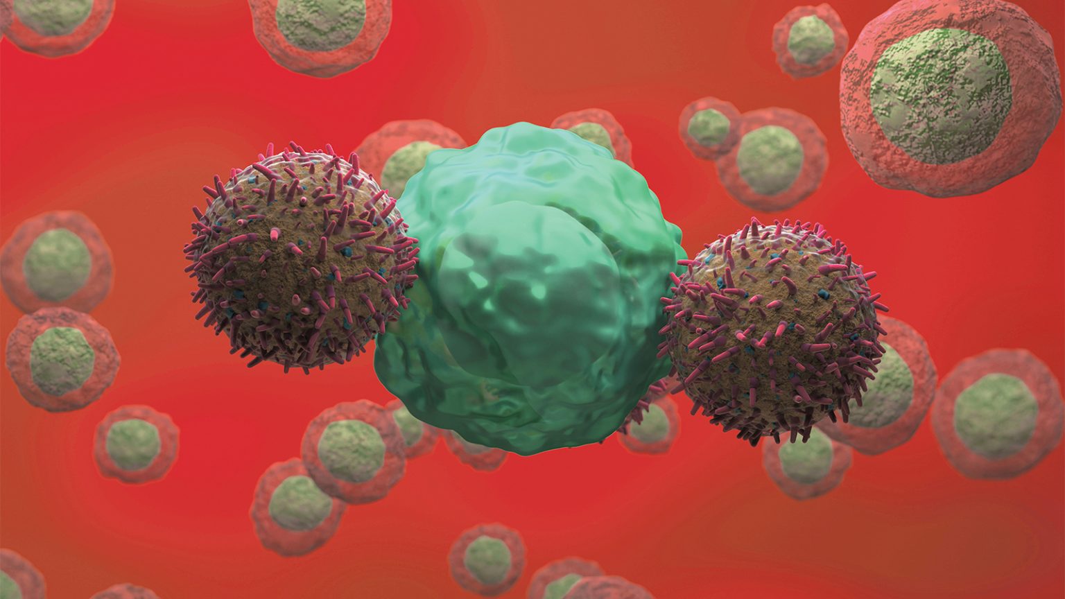 Neuroblastoma Patient Still in Remission 18 Years After CAR-T Infusion