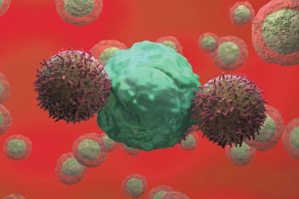 Neuroblastoma Patient Still in Remission 18 Years After CAR-T Infusion