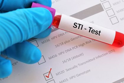 Survey Shows Youth Acceptance of STI Self-Collection Tests