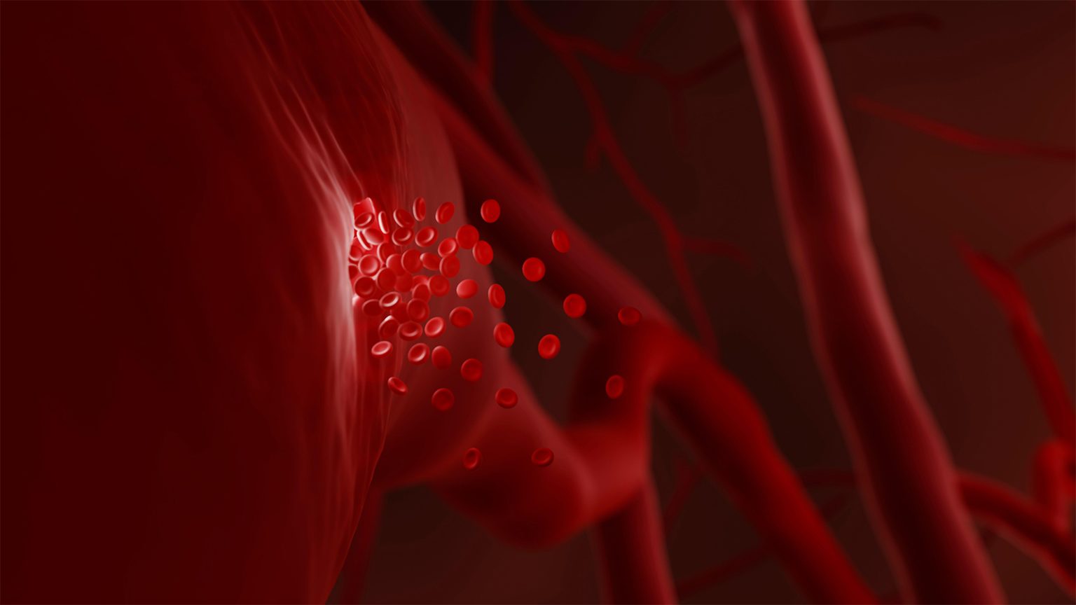 Cancer Diagnoses Cluster in Bleeders on Anticoagulation Therapy