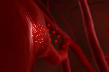 Cancer Diagnoses Cluster in Bleeders on Anticoagulation Therapy