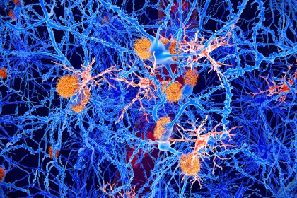 Surprising Findings From New Research About Dementia and Marriage