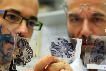 Alzheimer’s Research Caught in Trump Funding Delays