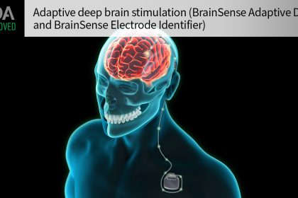 FDA Approves Adaptive Deep Brain Stimulator for Parkinson’s Disease