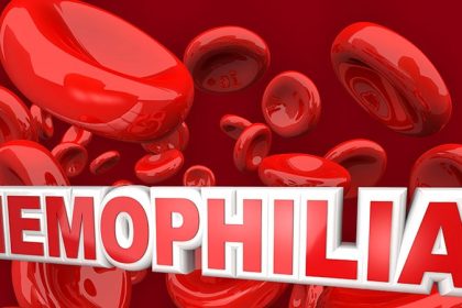 Fitusiran Approved for Hemophilia A, B
