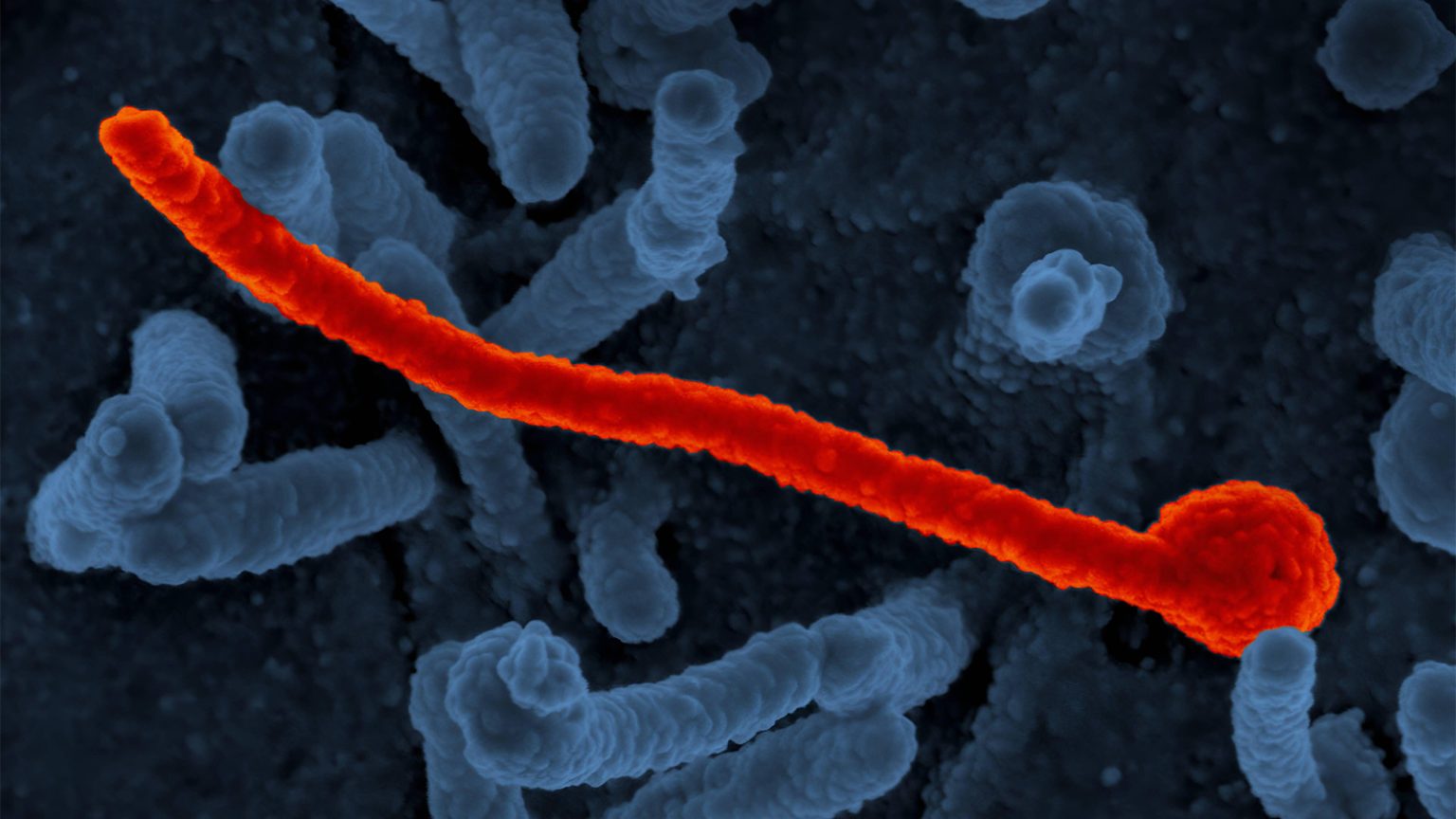 What Would You Do If an Ebola Patient Checked Into Your Hospital?